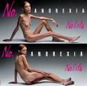 La Anorexia del griego apetito es un trastorno alimentario, que se caracteriza por la falta anormal de apetito, y que puede deberse a causas fisiológicas como por ejemplo, una gastroenteritis, que desaparece cuando cesa su causa; o bien a causas psicológicas, generalmente dentro de un cuadro depresivo por lo general en mujeres y adolescentes, y que puede ser muy grave.